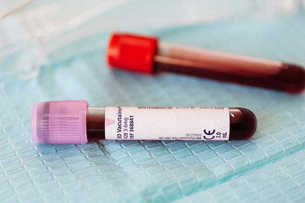 Kişilerin kan gruplarının ne olduğunu öğrenmek oldukça basit bir test ile gerçekleşebiliyor.