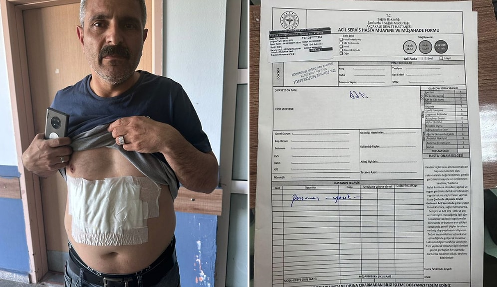 Blok Oy Kullanımına Karşı Çıkan Görevlinin Üzerine Kaynar Su Döküldüğü İddia Edildi