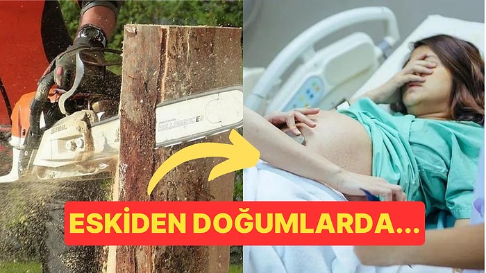 İlk Elektrikli Testerenin Çocuk Doğumunda Kullanılması İçin İcat Edildiğini Biliyor muydunuz?