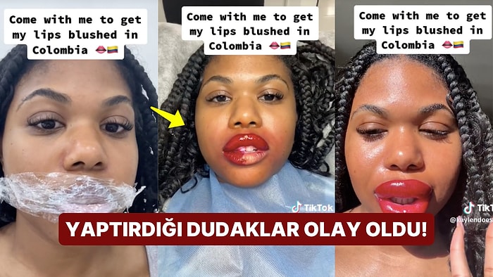 Yaptırdığı Dudak Dövmesi Faciayla Sonlandı: TikTok Kullanıcısının Dudak İşlemi Görenleri Hayrete Düşürdü!