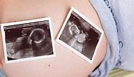 Женщина забеременела близнецами, и ее бесплодная сестра требует отдать одного ребенка