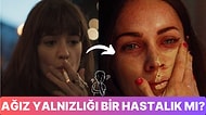 Asıl Adı Kuchi Zamishi Olan "Ağız Yalnızlığı" Aslında Nedir? Belirtileri ve Tedavi Türleri Nelerdir?