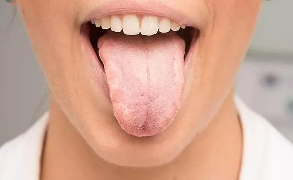 Dişin içinde bulunan canlı pulpa dokusu, dişin beslenmesini ve duyusunu sağlar. Ancak, pulpa zarar gördüğünde kendini iyileştirme yeteneği sınırlıdır.