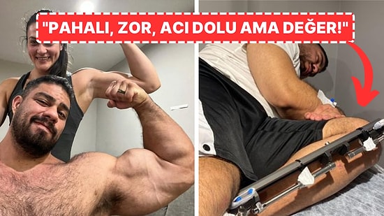 Boyunu Uzatmak İçin 100 Bin Dolar Harcayan Adamın Şoke Eden Açıklamaları: "Kayınçom Benden Uzundu!"