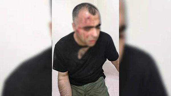 Bitlis Gazeteciler Cemiyeti Başkanı Gazeteci Sinan Aygül, Tatvan Belediye Başkanı Mehmet Emin Geylani'nin korumaları tarafından dövülmüştü