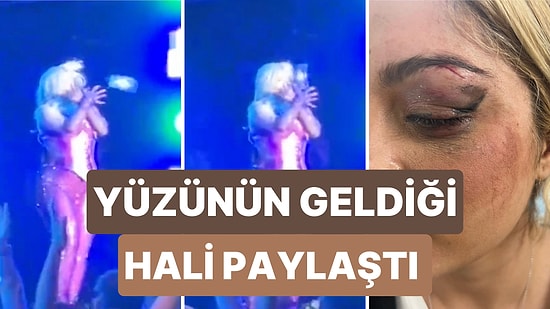 Ünlü Şarkıcı Bebe Rexha Konserinde Kafasına Atılan Telefon Sebebiyle Yaralandı