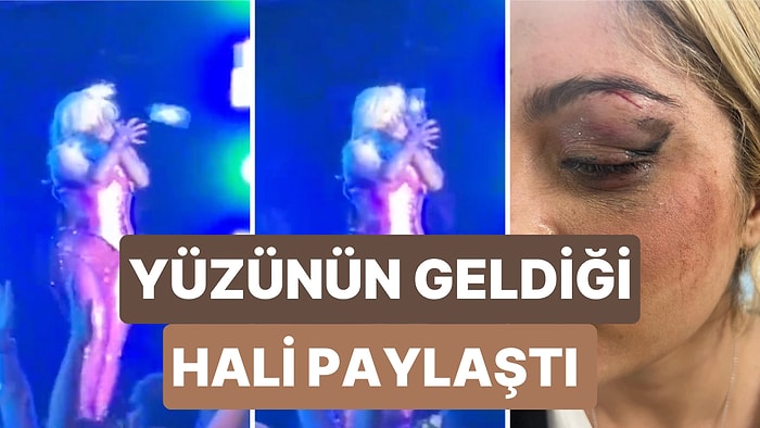 Ünlü Şarkıcı Bebe Rexha Konserinde Kafasına Atılan Telefon Sebebiyle Yaralandı