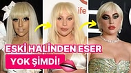 Lady Gaga'nın Yıldızının Parladığı İlk Yıldan Bugüne Kadar Geçirdiği Estetik Operasyonları Masaya Yatırıyoruz!