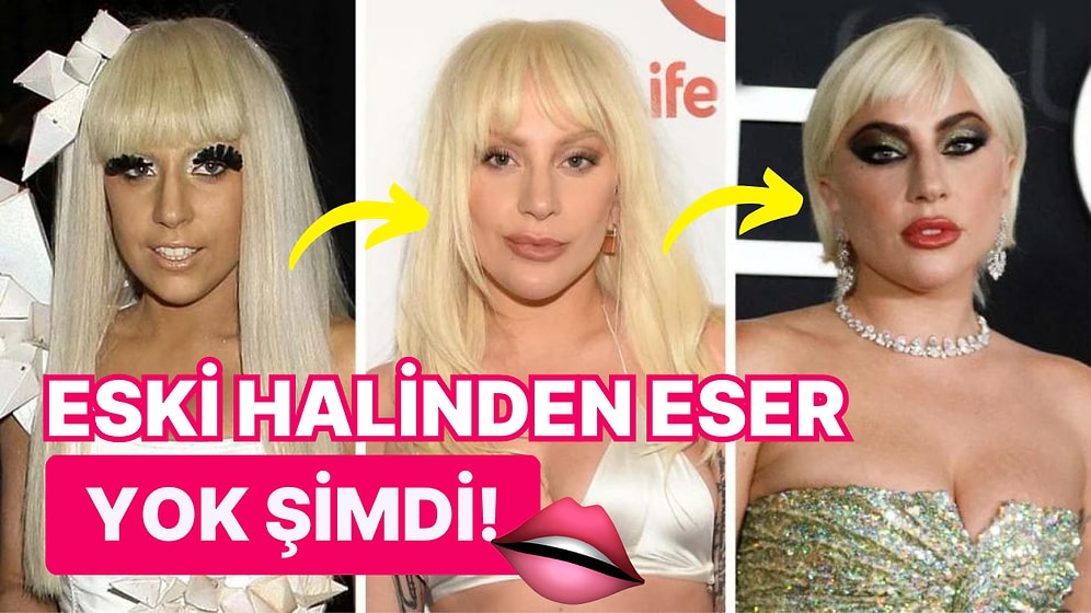 Lady Gaga'nın Yıldızının Parladığı İlk Yıldan Bugüne Kadar Geçirdiği Estetik Operasyonları Masaya Yatırıyoruz!