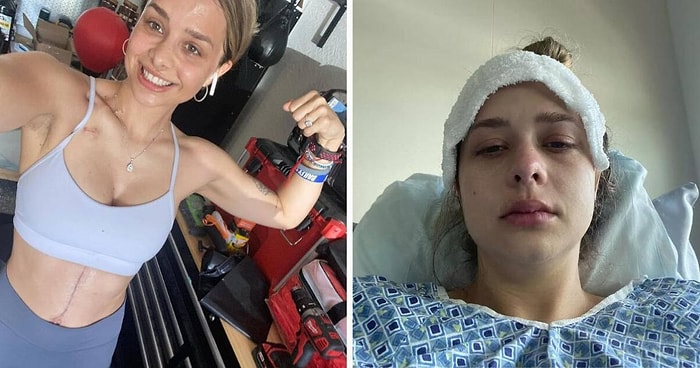 24-летняя девушка узнала, что у нее рак, и теперь предупреждает других о симптомах