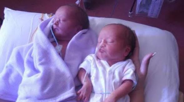 Родители близняшек с синдромом Дауна хотят встретиться с врачом, извинявшимся перед ними