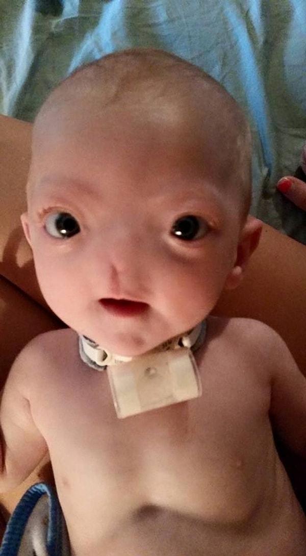 10. 2015 yılında Eli Thompson isimli bir bebek, burnu olmadan doğdu 👇