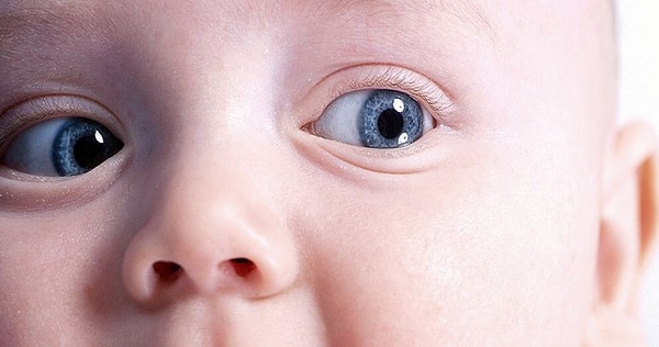 1. Глаза остаются  ___ на протяжении всей жизни человека.