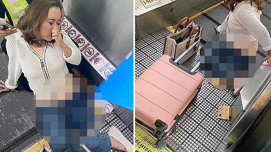 Yürüyen Banda Sıkışan Ayağı Kesilerek Kurtarıldı