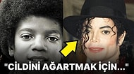 Michael Jackson'ın Yıllar Geçtikçe Beyazlamasına Sebep Olan 'Vitiligo' Hastalığı Nedir?