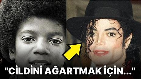 Michael Jackson'ın Yıllar Geçtikçe Beyazlamasına Sebep Olan 'Vitiligo' Hastalığı Nedir?