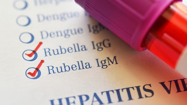 Hamilelikte Anti Rubella IgG testi nedir?