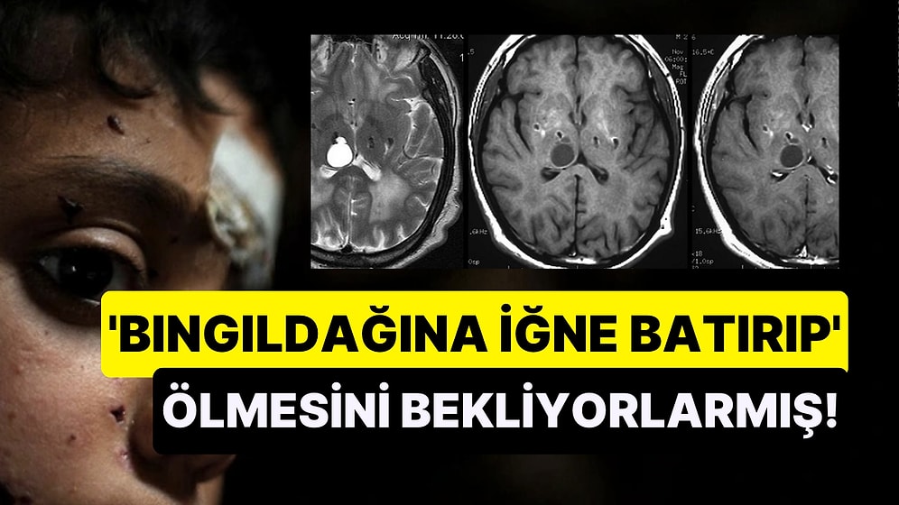 Ülkemizde Ailelerin İstenmeyen Çocukları Olduğunda Ölmesi için İşkence Yaptıkları Gerçeği "Pes" Dedirtti
