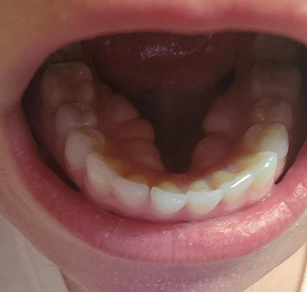 7. "Ağzımın içinde bir sürü diş var."