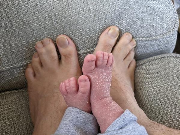 15. "Birleştirilmiş ayak parmaklarım oğluma miras kaldı."