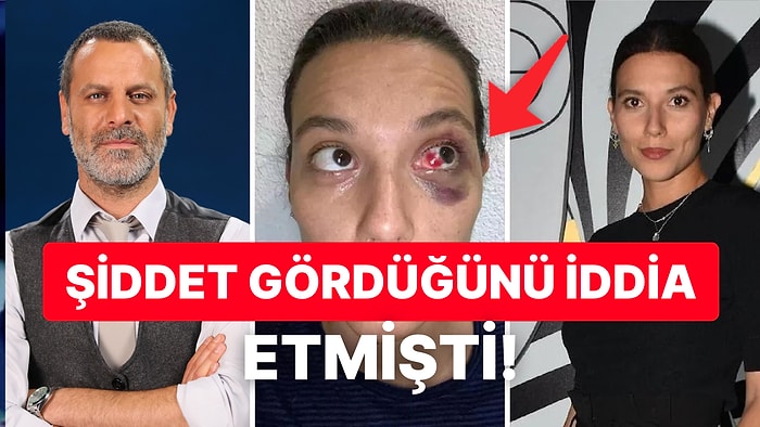 Ozan Güven ve Deniz Bulutsuz'un Darp Davasında Yeni Gelişme: Beklenen Adli Tıp Raporu Mahkemeye Ulaştı!