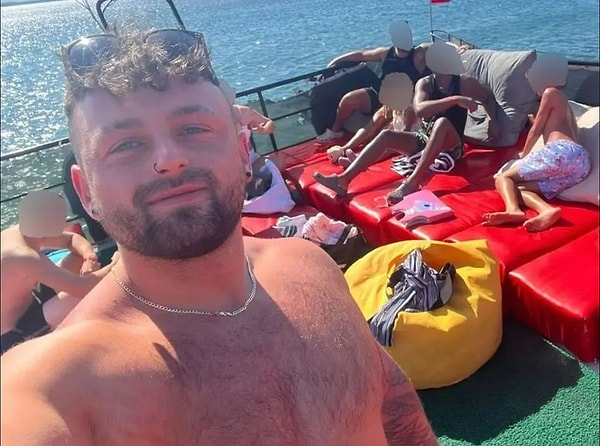 Birden çok kez burnunu kırmış eski bir rugby oyuncusu olan turist, çok fazla kanaması olduğu için tıbbi müdahaleye başvurduğunu ekledi. Burke, yüzüne 50 dikiş atıldığı iki saatlik bir ameliyat geçirmek zorunda kaldı.