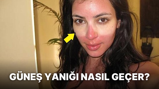 Güneş Yanığını En İyi Şekilde İyileştirmenin Yolları Nelerdir?