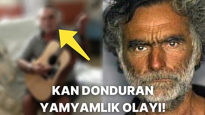 Tanımadığı Birinin Yamyamlık Saldırısına Uğrayarak Yüzünün Bir Kısmını Kaybeden Adamın Kan Donduran Hikayesi