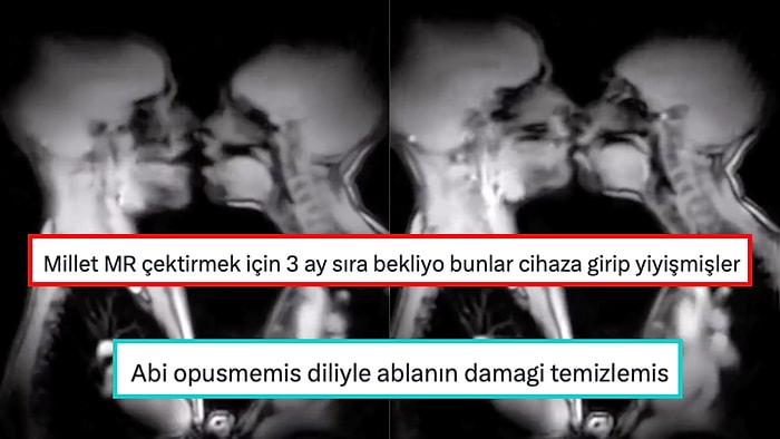 MR Cihazında Öpüşen İnsanların Videosuna Gelen Birbirinden Efsane Yorumlar Hepinizi Güldürecek