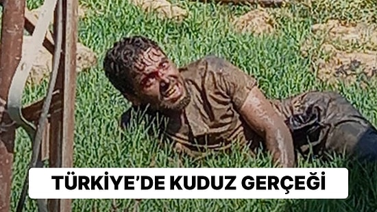 Kuduz Gerçeği: Türkiye En Riskli Ülkeler Seviyesine Yükseltildi