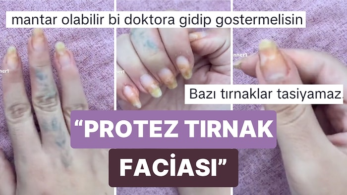 Yaptırdığı Protez Tırnak Sonrası Ellerinin Gördüğü Hasarı Gösteren Kadın Pişmanlığını Takipçileriyle Paylaştı