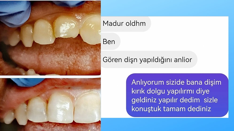 Dolgusundan Rahatsız Olan Hasta ve Diş Hekimi Arasındaki Diyalog Viral OIdu