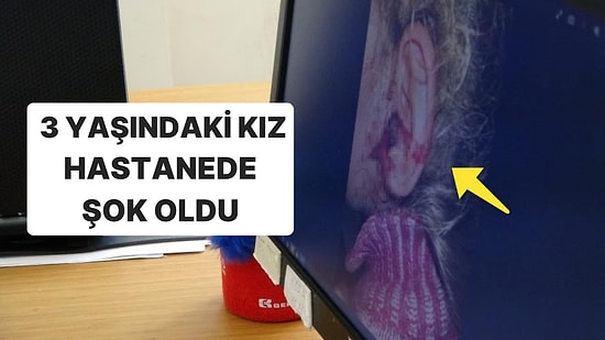 Kişisel Temizliğe Dikkat: Kulağından Larvalar Çıktı