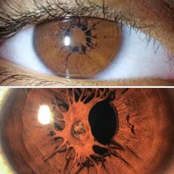 2. İşte gözbebeğinizin üzerinde bir iris büyümeye başladığında böyle gözükür.