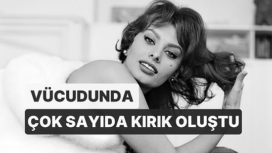 Sophia Loren Hastaneye Kaldırıldı: Vücudunda Çok Sayıda Kırık Oluştu