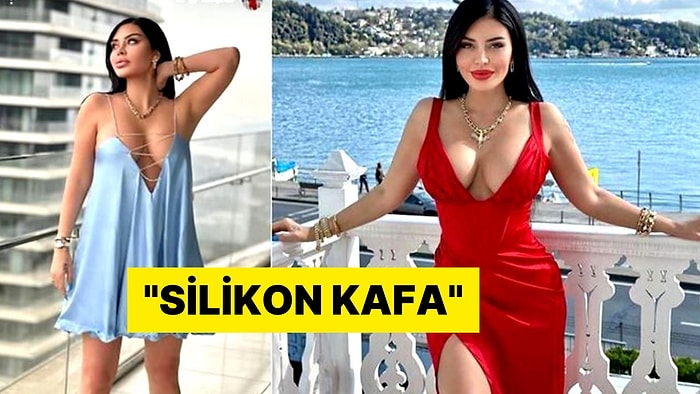 Ebru Polat O Çirkin Yoruma Sessiz Kalmadı: Suç Duyurusunda Bulundu