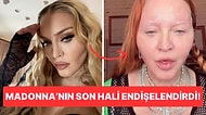 Pop Dünyasının Vazgeçilmez İsmi Madonna'nın Son Hali Görenleri Korkuttu!