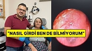 Hışırtı Sebebiyle Hastaneye Giden Kadının Kulağından Yuva Yapmış Canlı Örümcek Çıktı