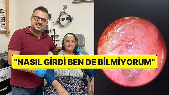 Hışırtı Sebebiyle Hastaneye Giden Kadının Kulağından Yuva Yapmış Canlı Örümcek Çıktı