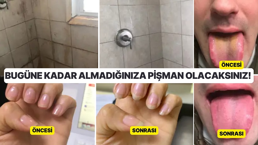 Her Gün Kullanarak Faydasını Sonuna Kadar Göreceğiniz 13 Ürün Önerisi