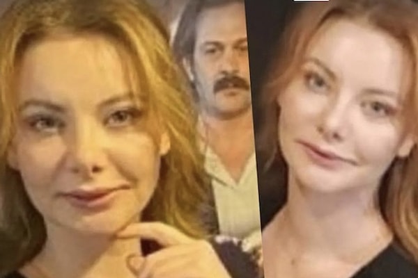 Geçtiğimiz günlerde görüntülenen Sedef Şahin, özellikle dudağına yeni yaptırdığı işlemlerin fazlalığı ve değişimi ile oldukça dikkat çekti.