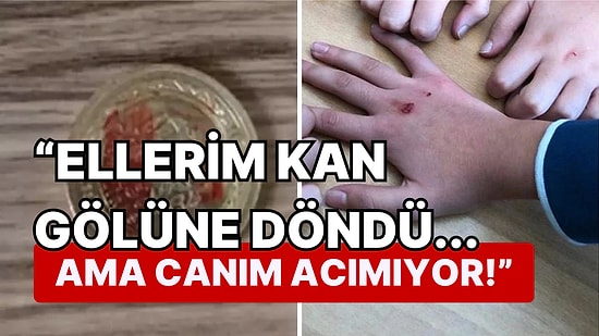 Okullarda Çocukların Kemiklerini Çatlatana Kadar Oynadığı 'Kanlı Para Oyunu' Giderek Yaygınlaşıyor!