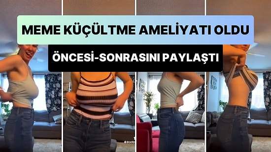 'Meme Küçültme' Ameliyatı Olan TikToker Kadın Memelerinin Öncesi ve Sonrası Görüntülerini Paylaştı