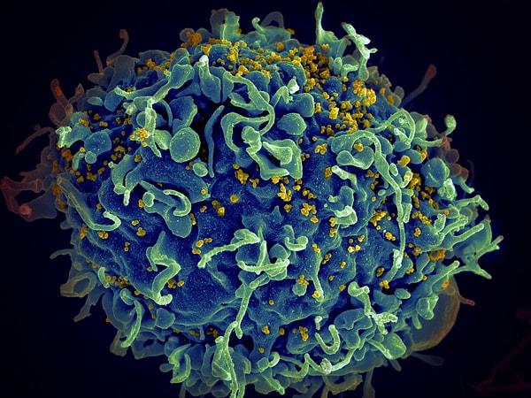 "Edinilmiş bağışıklık yetersizliği sendromu" anlamına gelen AIDS, HIV'in en ileri aşamasıdır ve hayati risk taşır.