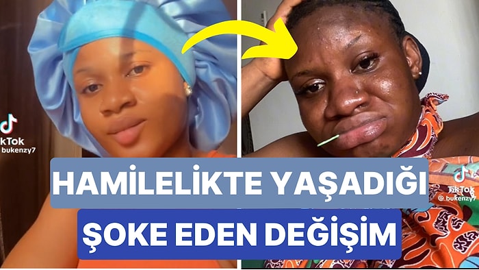 Hamilelik Sürecinde Çok Güzel Görüneceğini Düşünen Kadının O Süreçte Yaşadığı Değişim Görenleri Şoke Etti