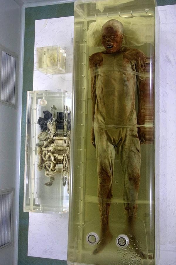5. 60 yaşındaki Sui Shaoyan'ın 2.200 yıllık mumyası.