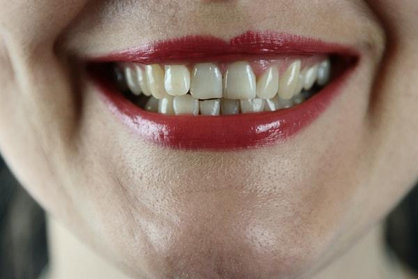 12. "Gerçekten de zengin olan insanlar altın kaplama dişlerle dolaşmaz. Genelde diş problemlerini çoktan çözmüşlerdir ya da pahalı diş takımları veya implantlar kullanıyorlardır."