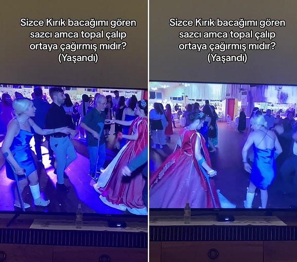 Ayağı kırılan kadın gittiği düğünde yaşadığı efsane olayı TikTok'ta paylaştı.