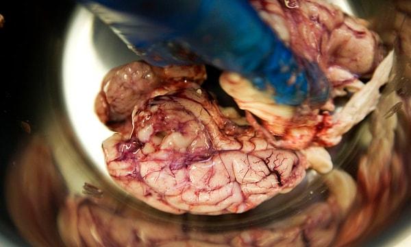 ABD'nin Teksas eyaletinde bulunan Teksas Üniversitesi Southwestern Tıp Merkezi'nde çalışan araştırmacılar, ketamin ile uyutulan bir domuzun beynine giden kan akışını başarıyla izole ettiler.