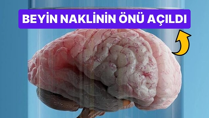 Bilim İnsanları Vücuttan Çıkardıkları Beyni Canlı Tutmayı Başarabilen Bir Cihaz Geliştirdiler